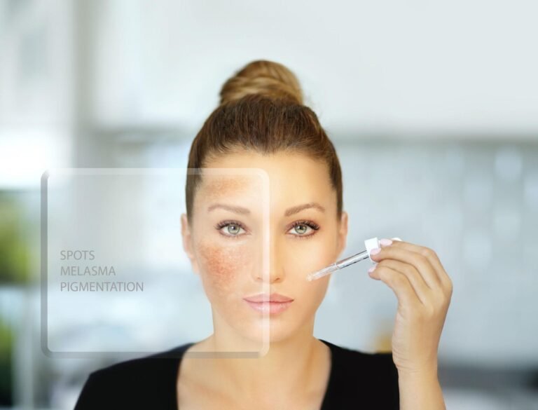 Hydroquinone Cream